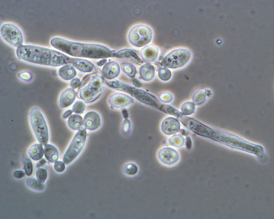 Hefen, Andreas Aurich/UFZ